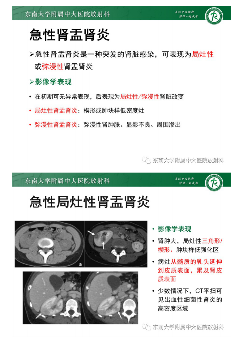 20210222_2【晨读结果公布】2021.02.22泌尿系统疾病——肾盂肾炎.pdf 第5页