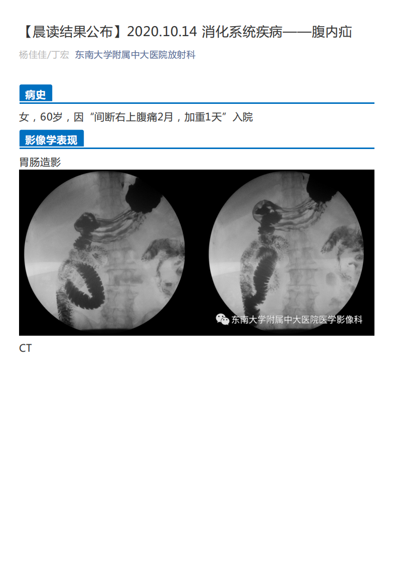 20201014_2【晨读结果公布】2020.10.14消化系统疾病——腹内疝.pdf 第1页