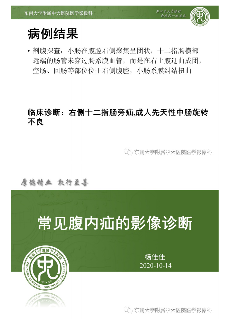 20201014_2【晨读结果公布】2020.10.14消化系统疾病——腹内疝.pdf 第5页