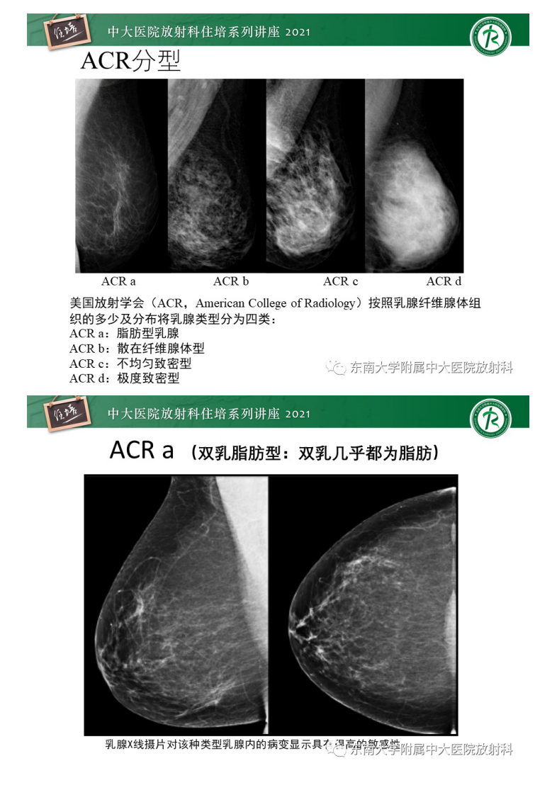 20210228_1【中大放射住培系列讲座】DBT相较于FFDM对于不同X线表现类型乳腺病变的诊断价值.pdf 第4页