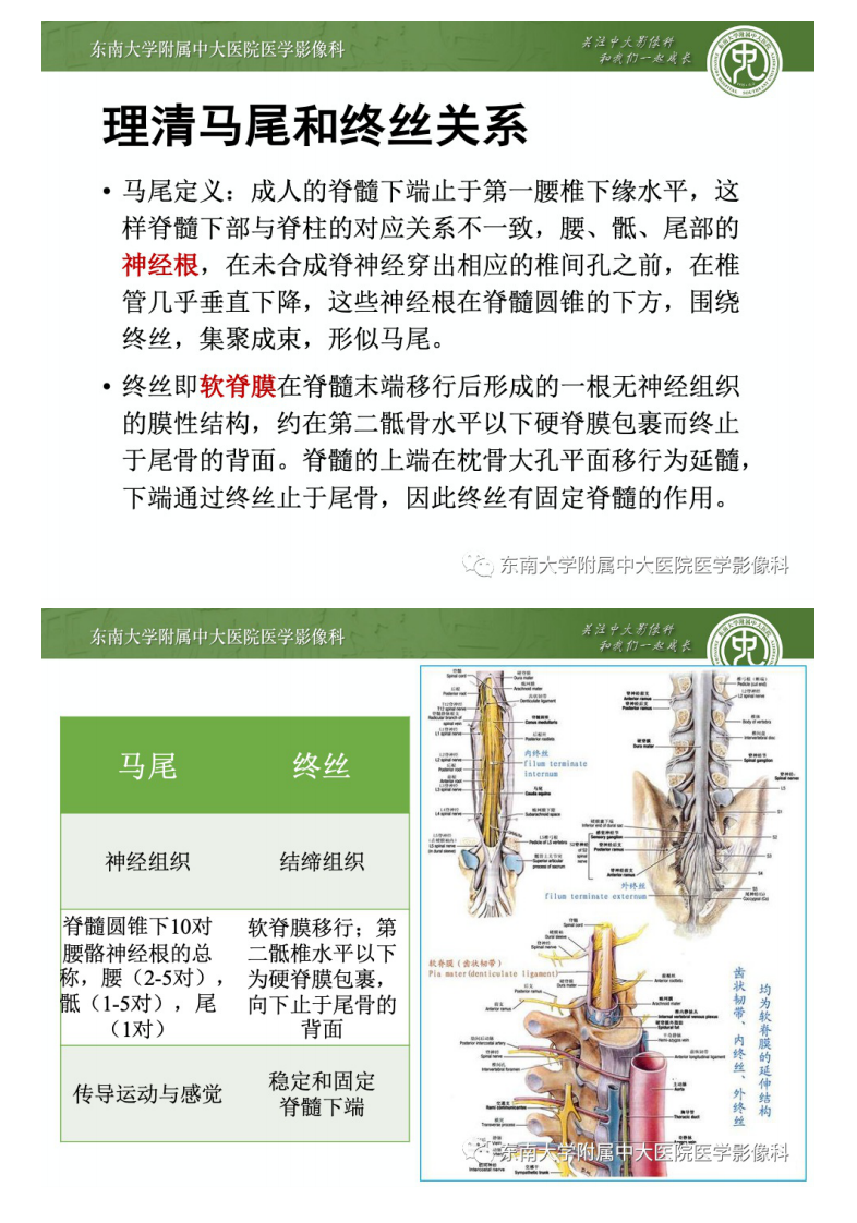 20201130_3【晨读结果公布】2020.11.30神经系统疾病——马尾终丝髓外硬膜下肿瘤诊断思路.pdf 第5页