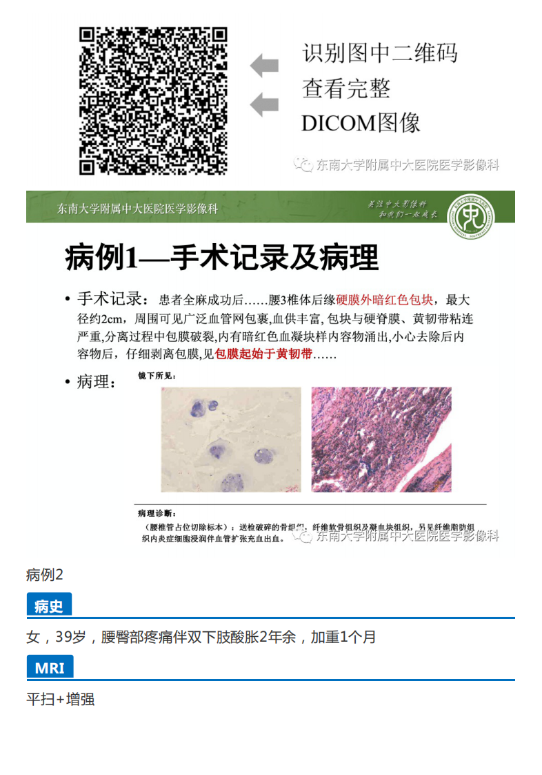 20201130_3【晨读结果公布】2020.11.30神经系统疾病——马尾终丝髓外硬膜下肿瘤诊断思路.pdf 第2页