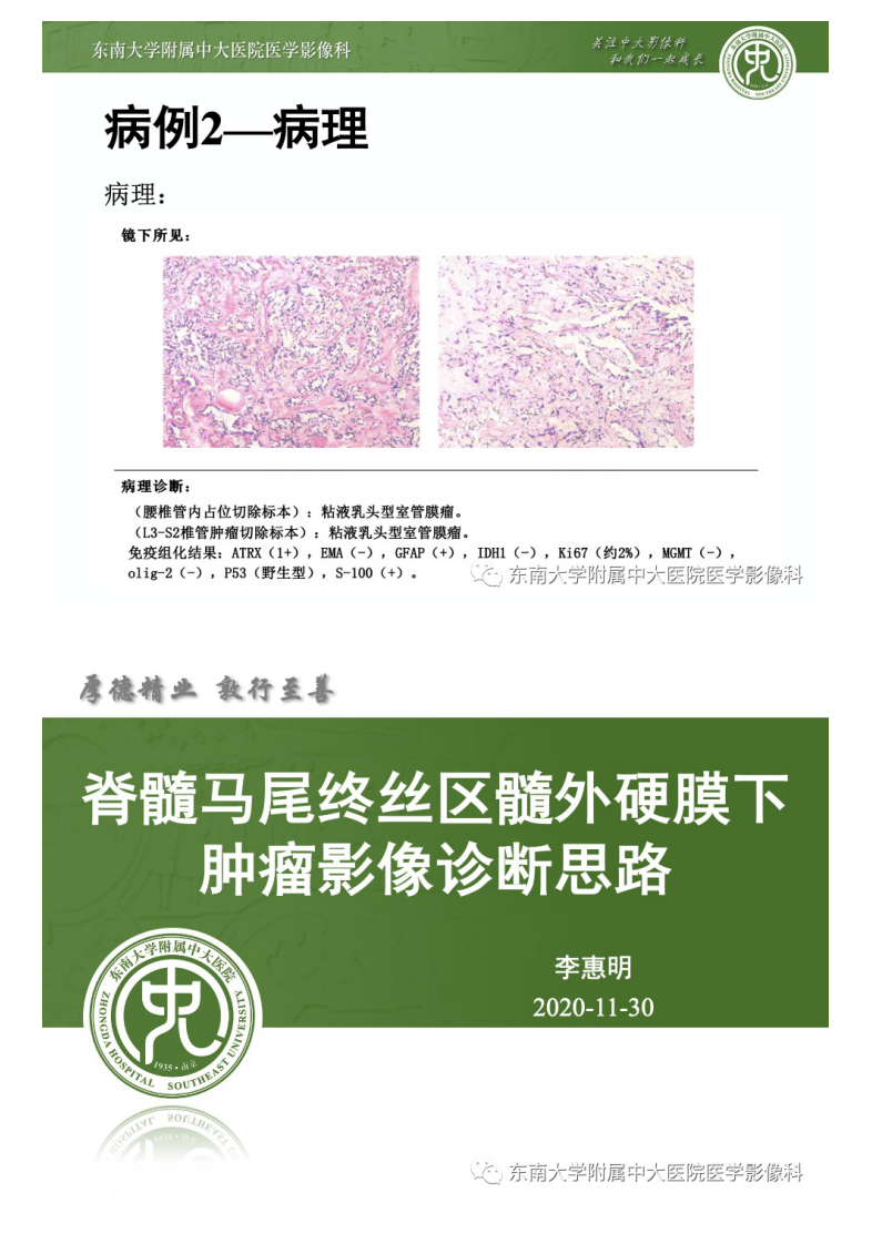 20201130_3【晨读结果公布】2020.11.30神经系统疾病——马尾终丝髓外硬膜下肿瘤诊断思路.pdf 第4页