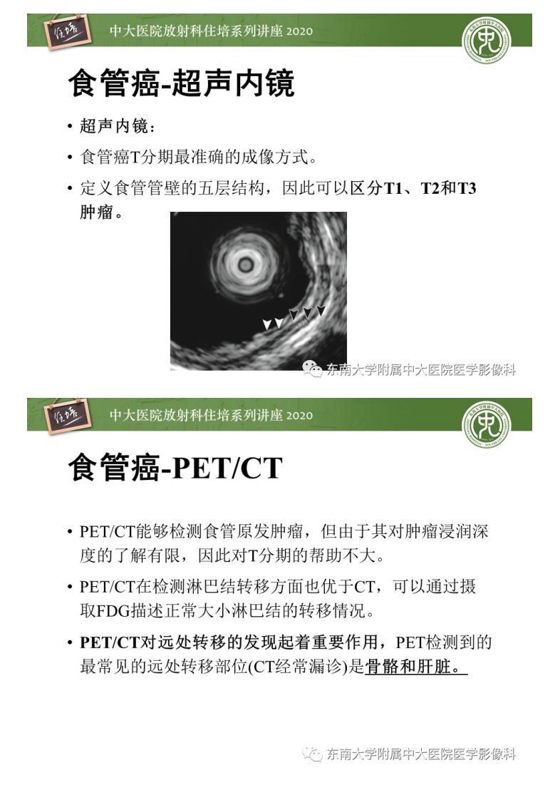 20201026_1【中大放射住培系列讲座】食管癌影像-临床分期.pdf 第5页
