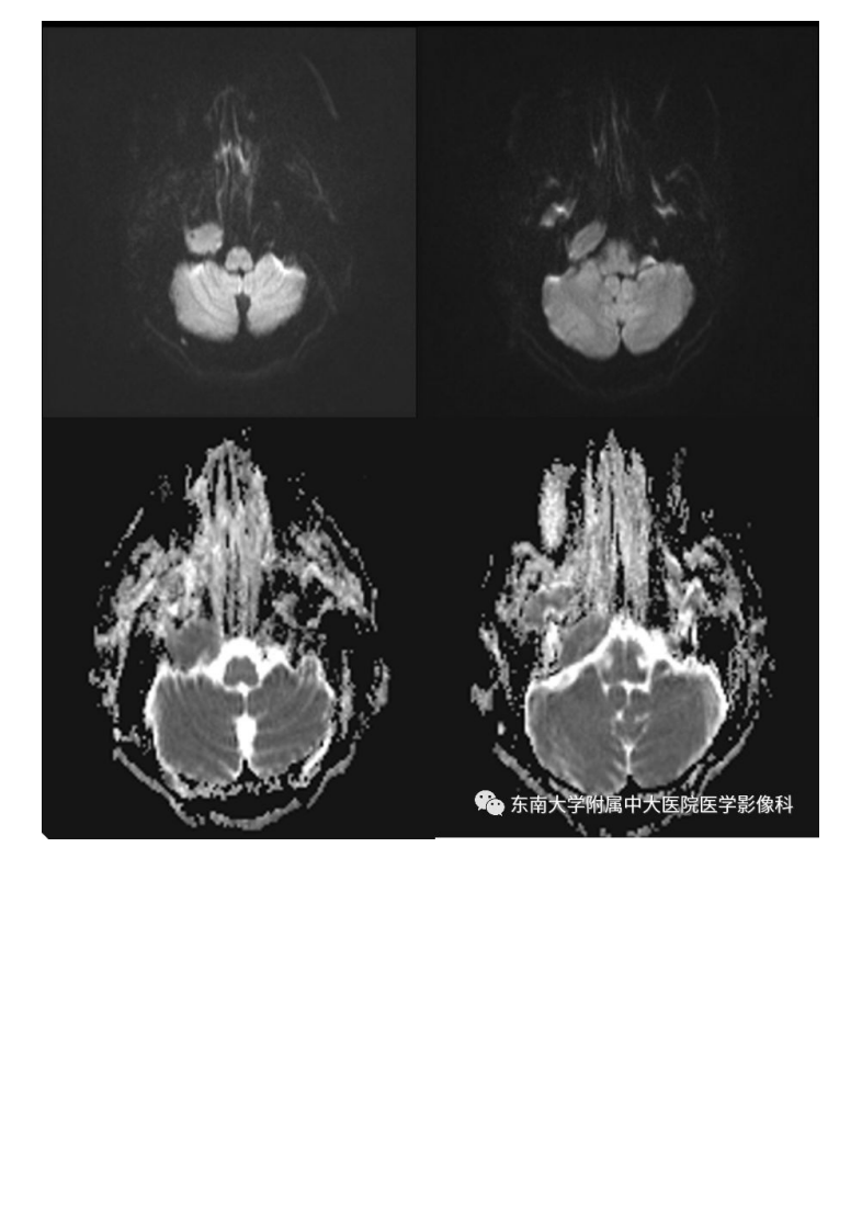 20190930_3【晨读结果公布】2019.09.29头颈部系统疾病.pdf 第4页