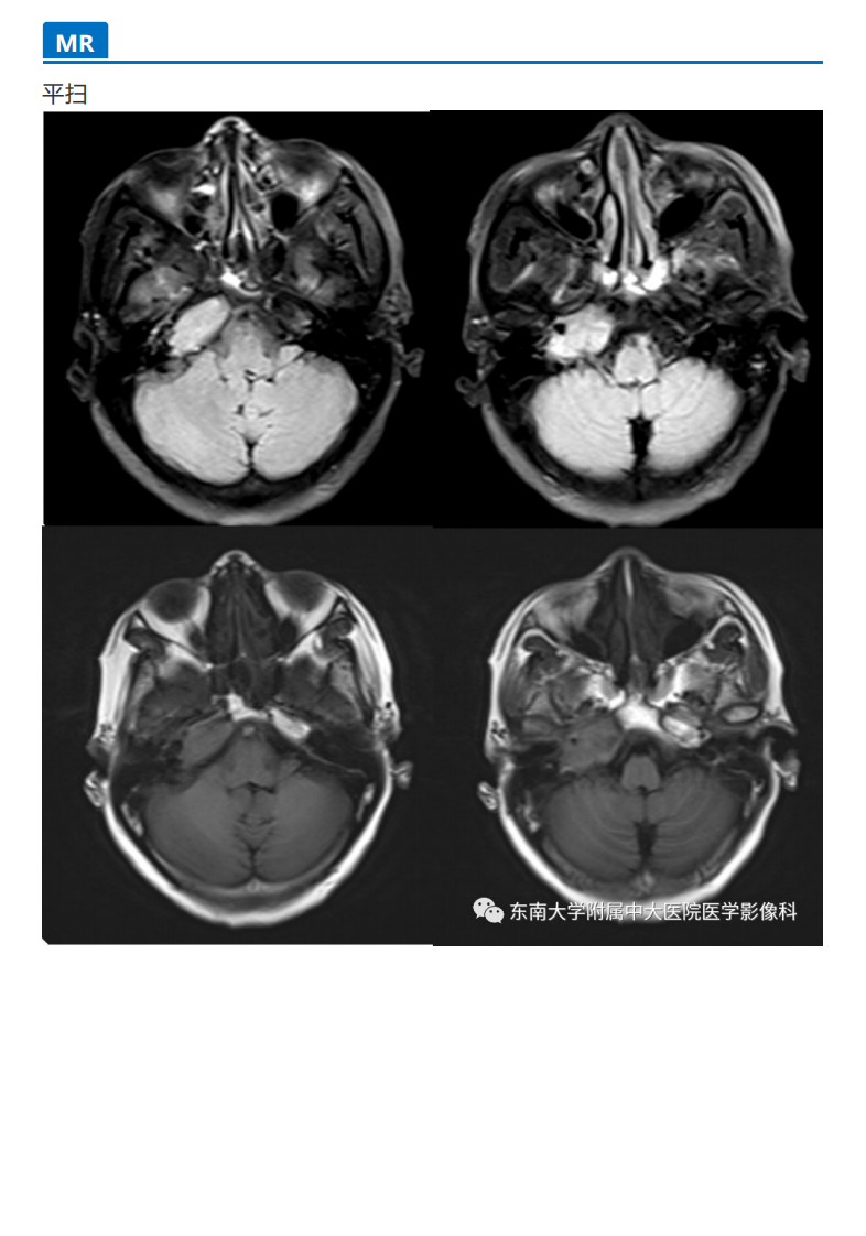 20190930_3【晨读结果公布】2019.09.29头颈部系统疾病.pdf 第3页