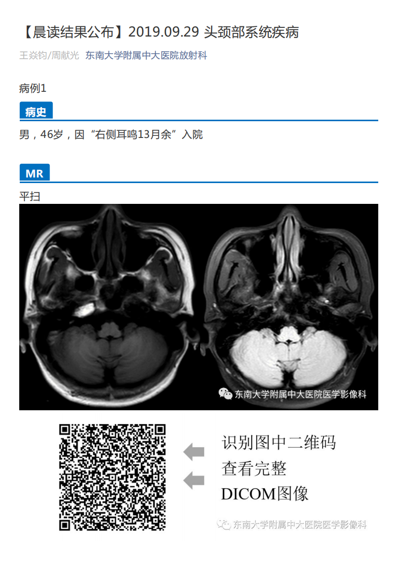 20190930_3【晨读结果公布】2019.09.29头颈部系统疾病.pdf 第1页