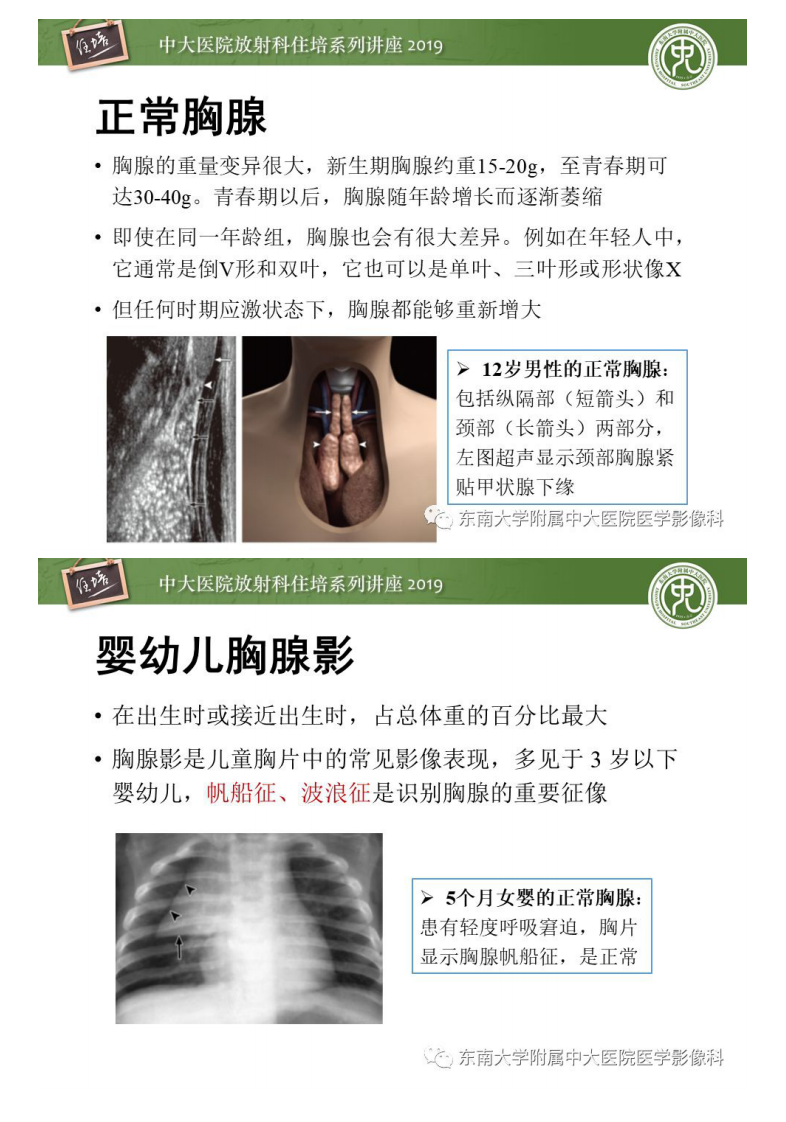 20190922_1【2019住培系列讲座第78期】胸腺上皮性肿瘤的影像诊断及鉴别.pdf 第3页