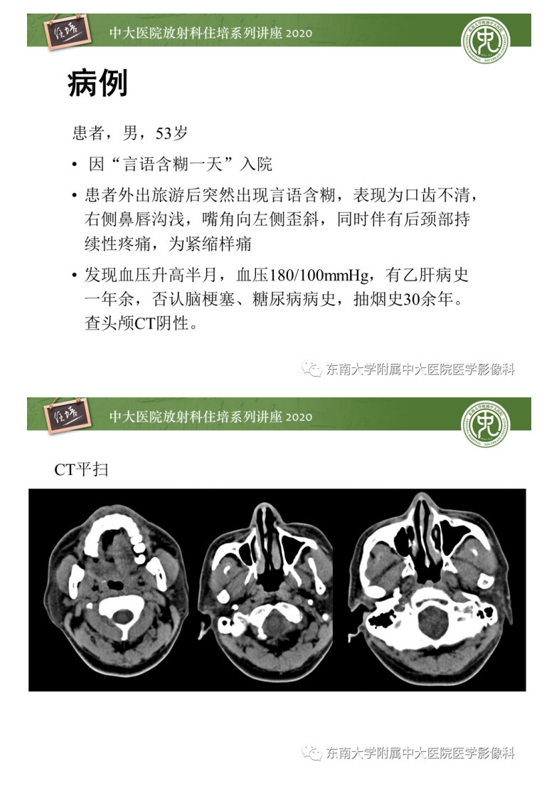 20200419_1【中大放射住培系列讲座】颈动脉夹层及夹层动脉瘤的影像诊断及评估.pdf 第2页