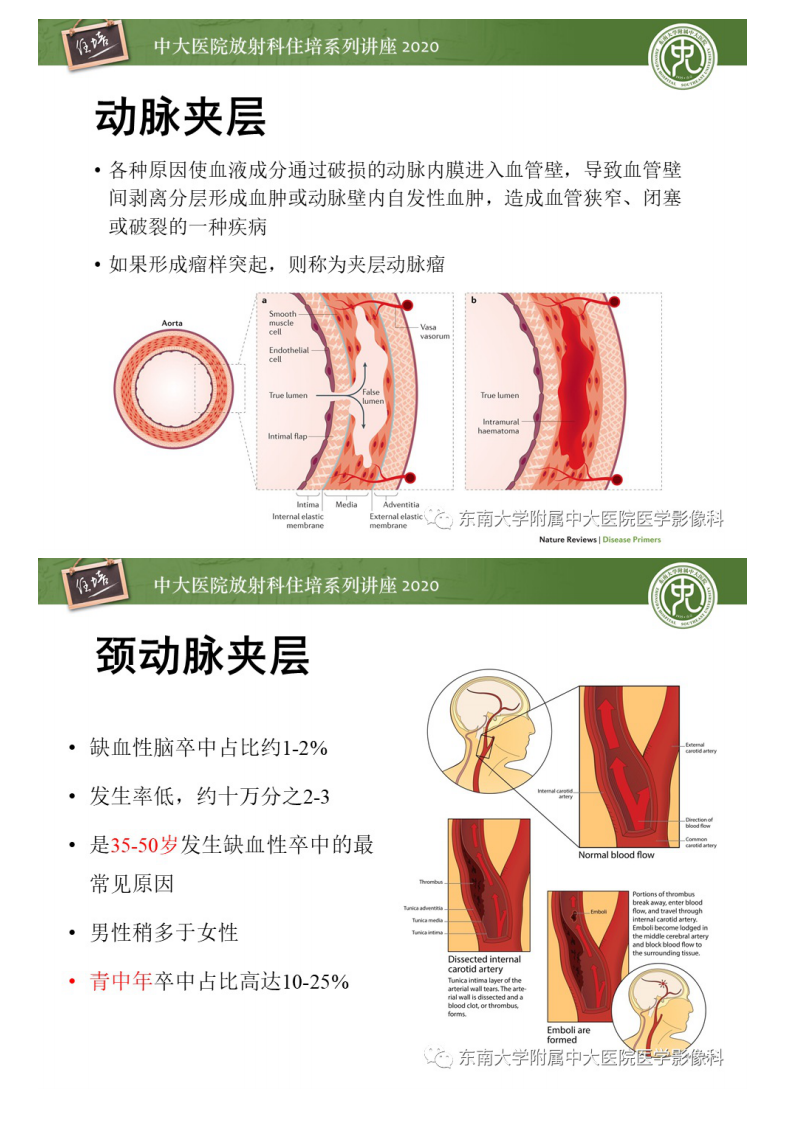 20200419_1【中大放射住培系列讲座】颈动脉夹层及夹层动脉瘤的影像诊断及评估.pdf 第4页