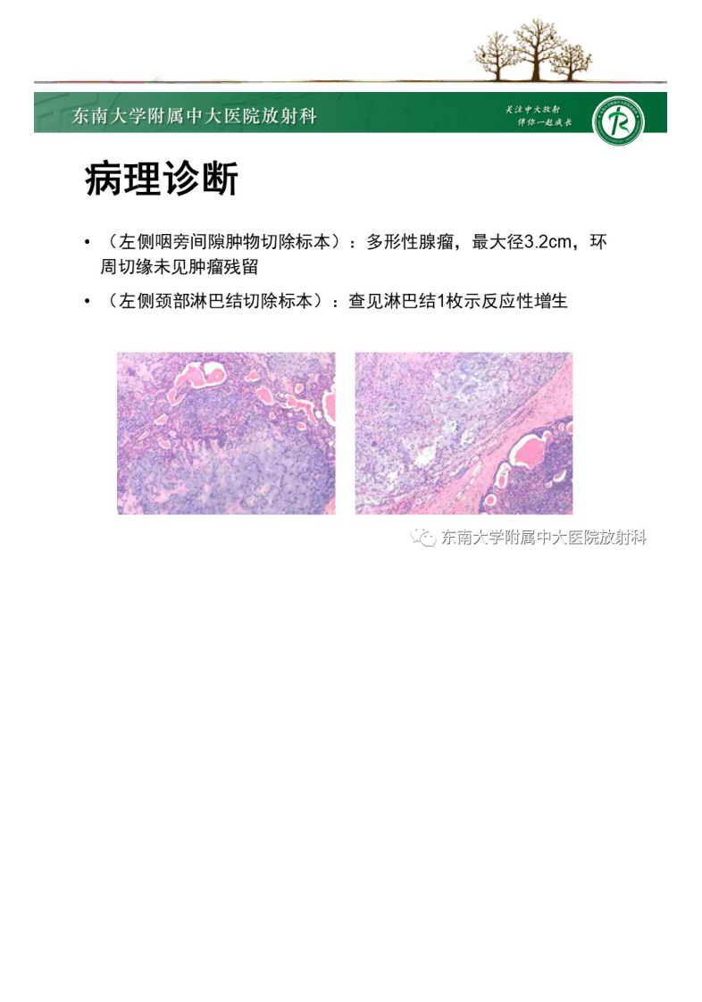 20210617_2【晨读结果公布】2021.06.17头颈部疾病——多形性腺瘤.pdf 第4页