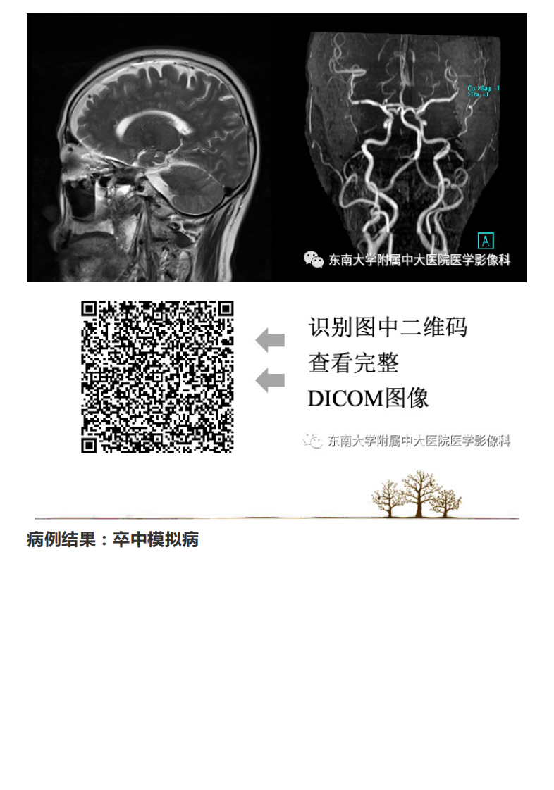 20201216_2【晨读结果公布】2020.12.15神经系统疾病&mdash;&mdash;脑卒中模拟病.pdf 第3页
