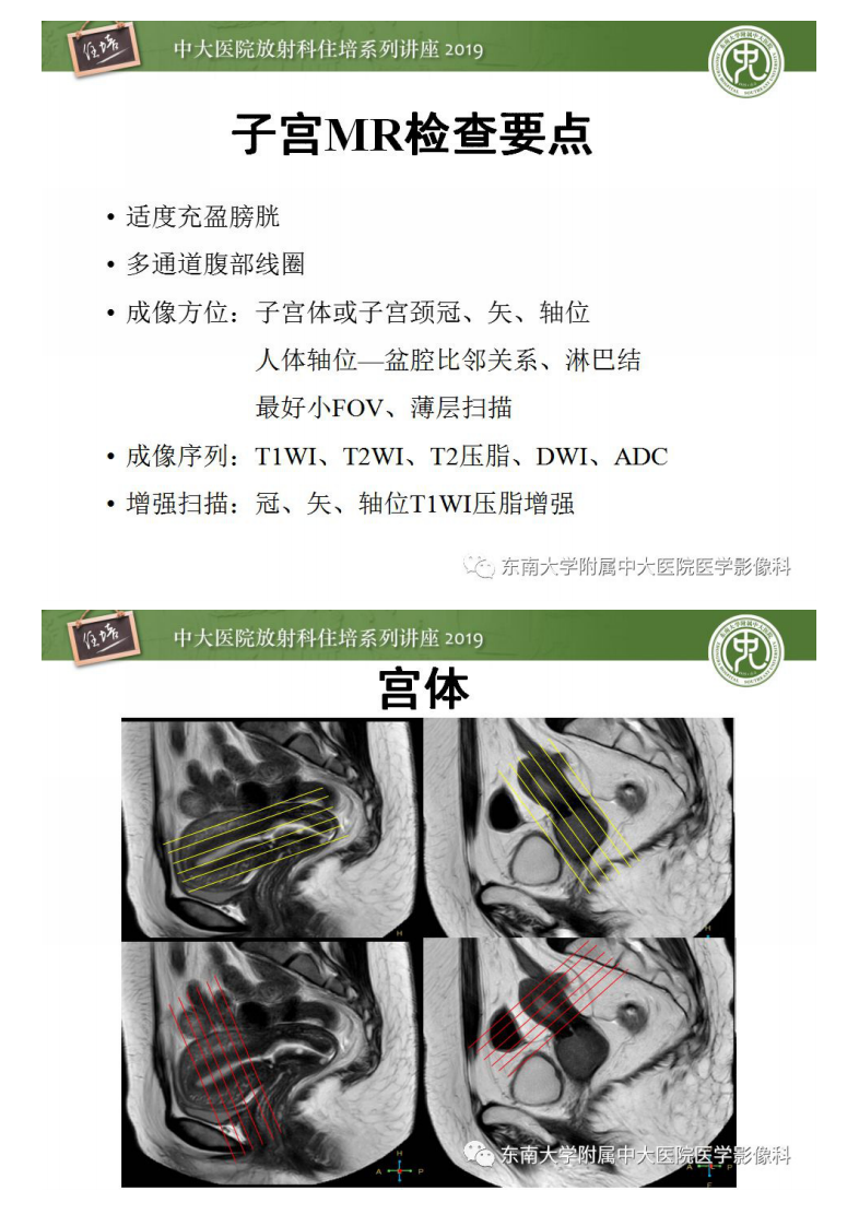 20190303_1【中大放射住培系列讲座第51期】子宫影像解剖及相关MR信号分析.pdf 第3页