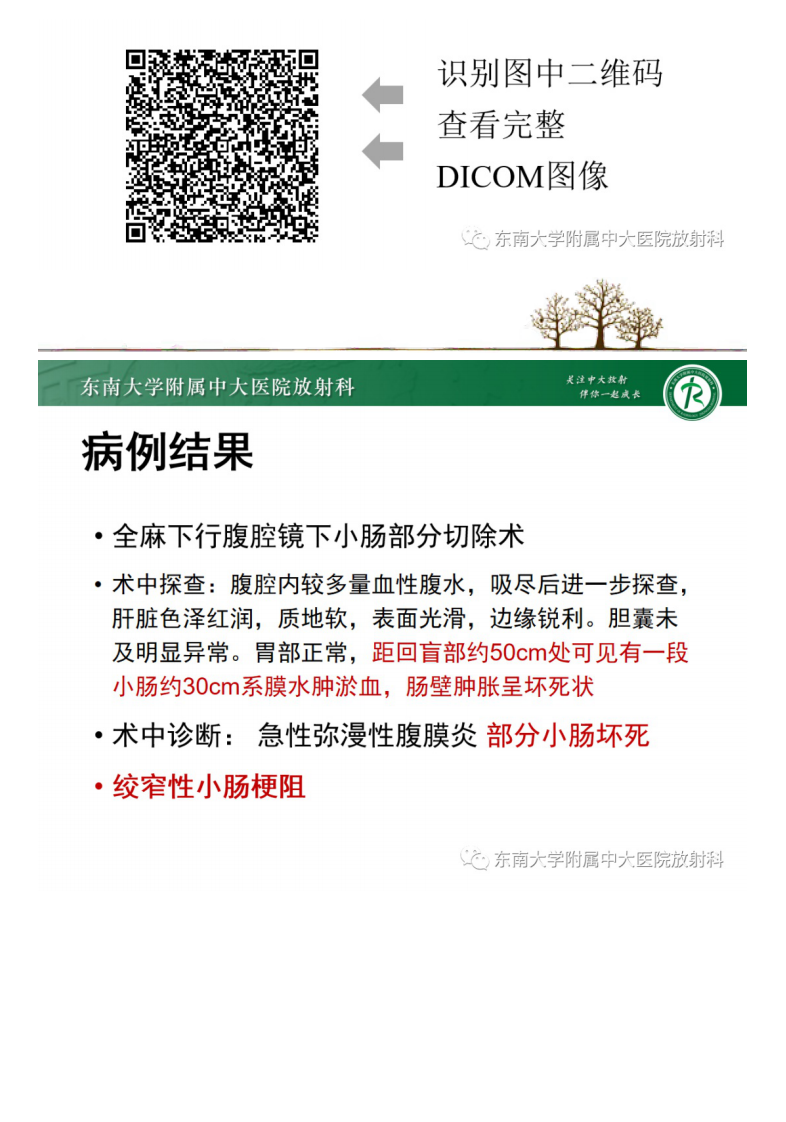 20210530_2【晨读结果公布】2021.05.28消化系统疾病&mdash;&mdash;绞窄性肠梗阻.pdf 第2页