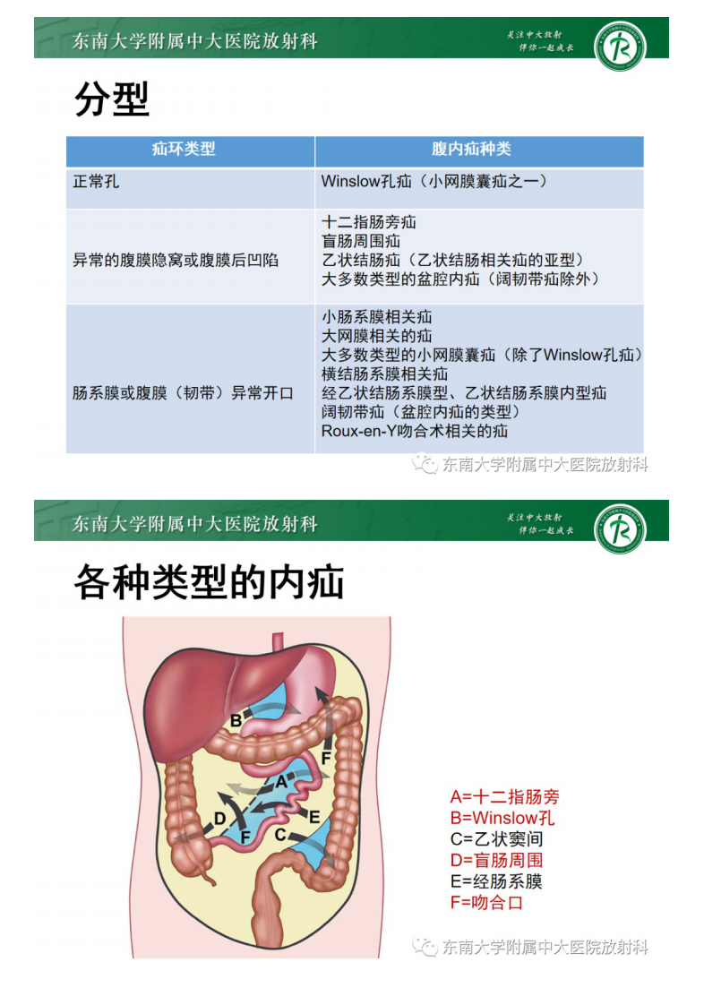 20210530_2【晨读结果公布】2021.05.28消化系统疾病&mdash;&mdash;绞窄性肠梗阻.pdf 第5页