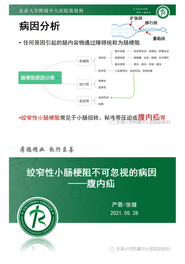 20210530_2【晨读结果公布】2021.05.28消化系统疾病&mdash;&mdash;绞窄性肠梗阻.pdf 第3页