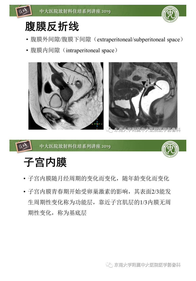 20200204_1【中大放射住培系列讲座】子宫影像解剖及相关MR信号分析.pdf 第5页