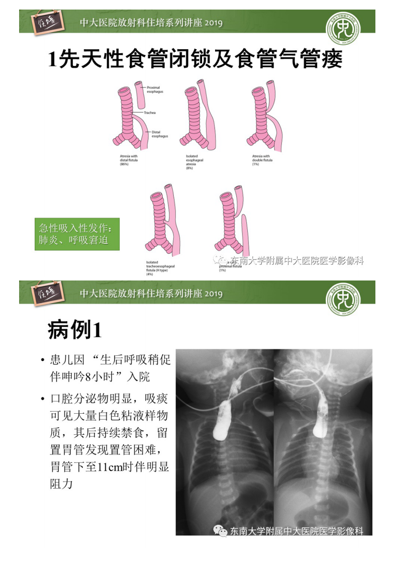 20200401_1【中大放射住培系列讲座】呼吸系统急症影像解读.pdf 第3页