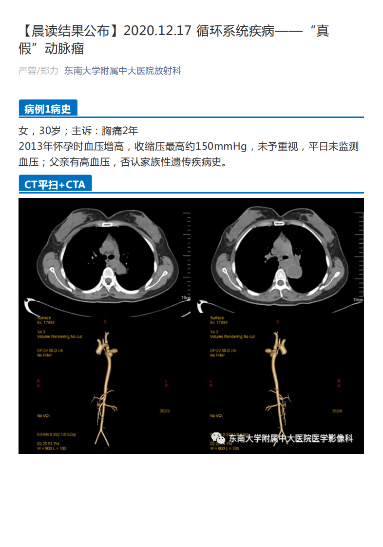 20201218_2【晨读结果公布】2020.12.17循环系统疾病——“真假”动脉瘤.pdf 第1页
