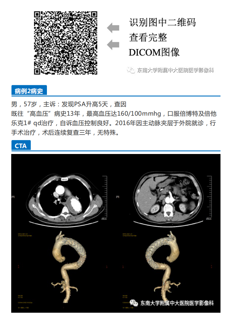 20201218_2【晨读结果公布】2020.12.17循环系统疾病——“真假”动脉瘤.pdf 第2页