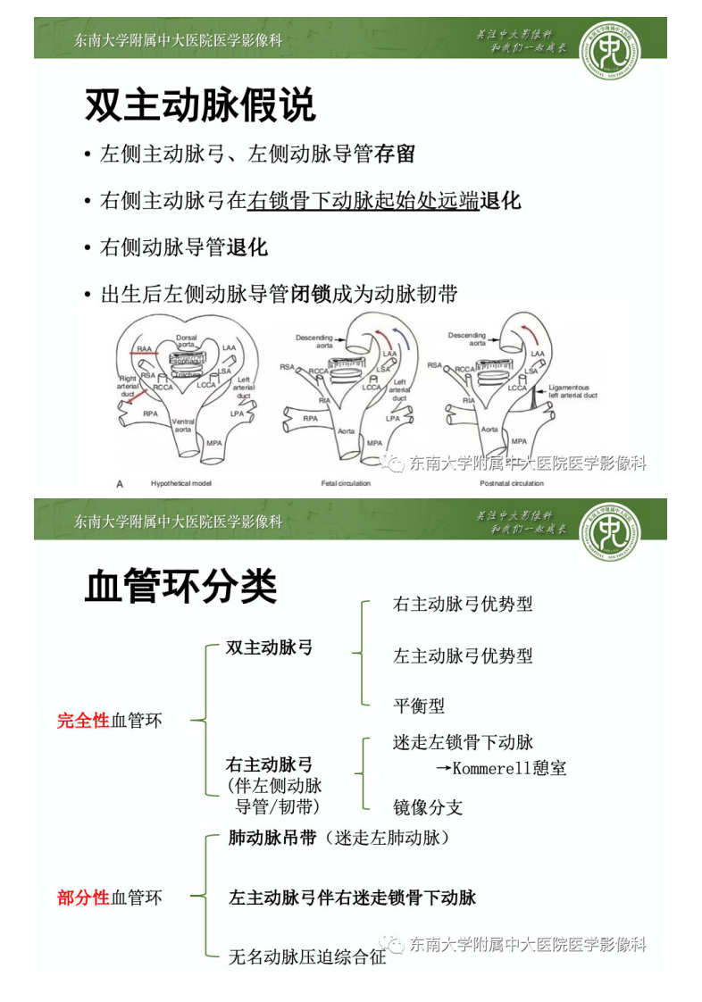 20201227_2【晨读结果公布】2020.12.25循环系统疾病——先天性血管环.pdf 第4页