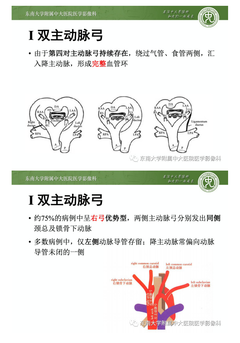 20201227_2【晨读结果公布】2020.12.25循环系统疾病——先天性血管环.pdf 第5页