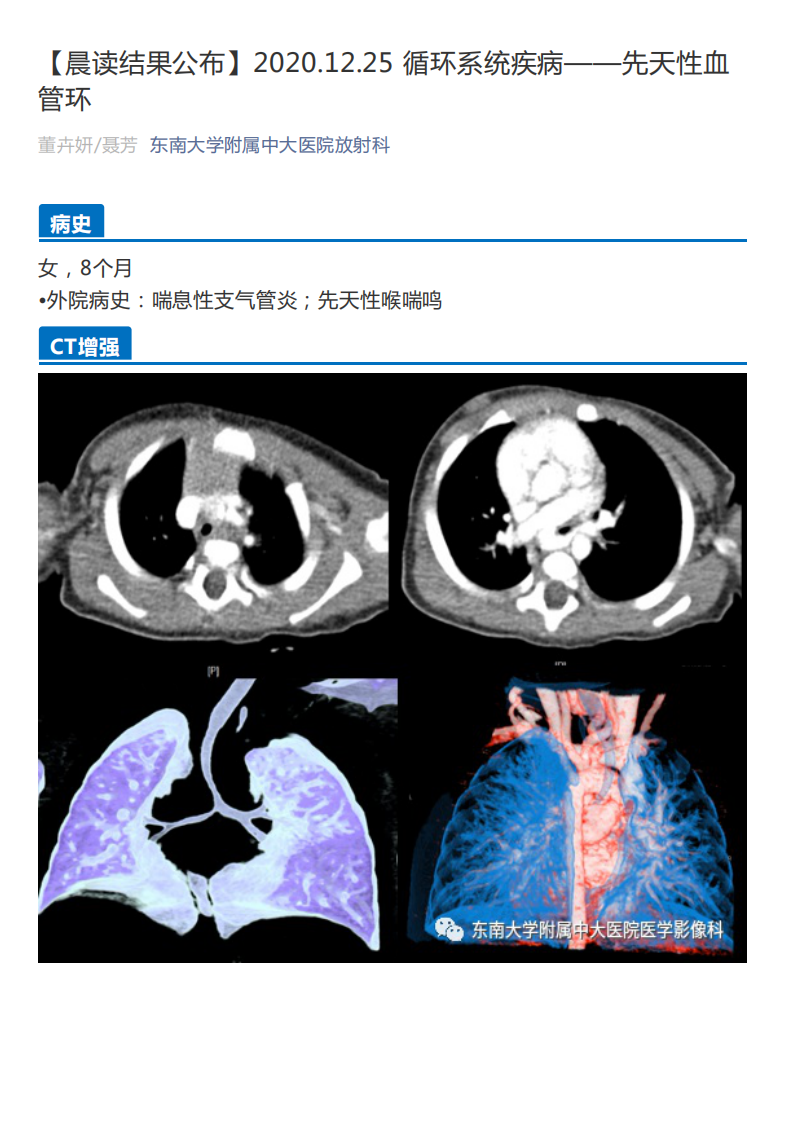 20201227_2【晨读结果公布】2020.12.25循环系统疾病——先天性血管环.pdf