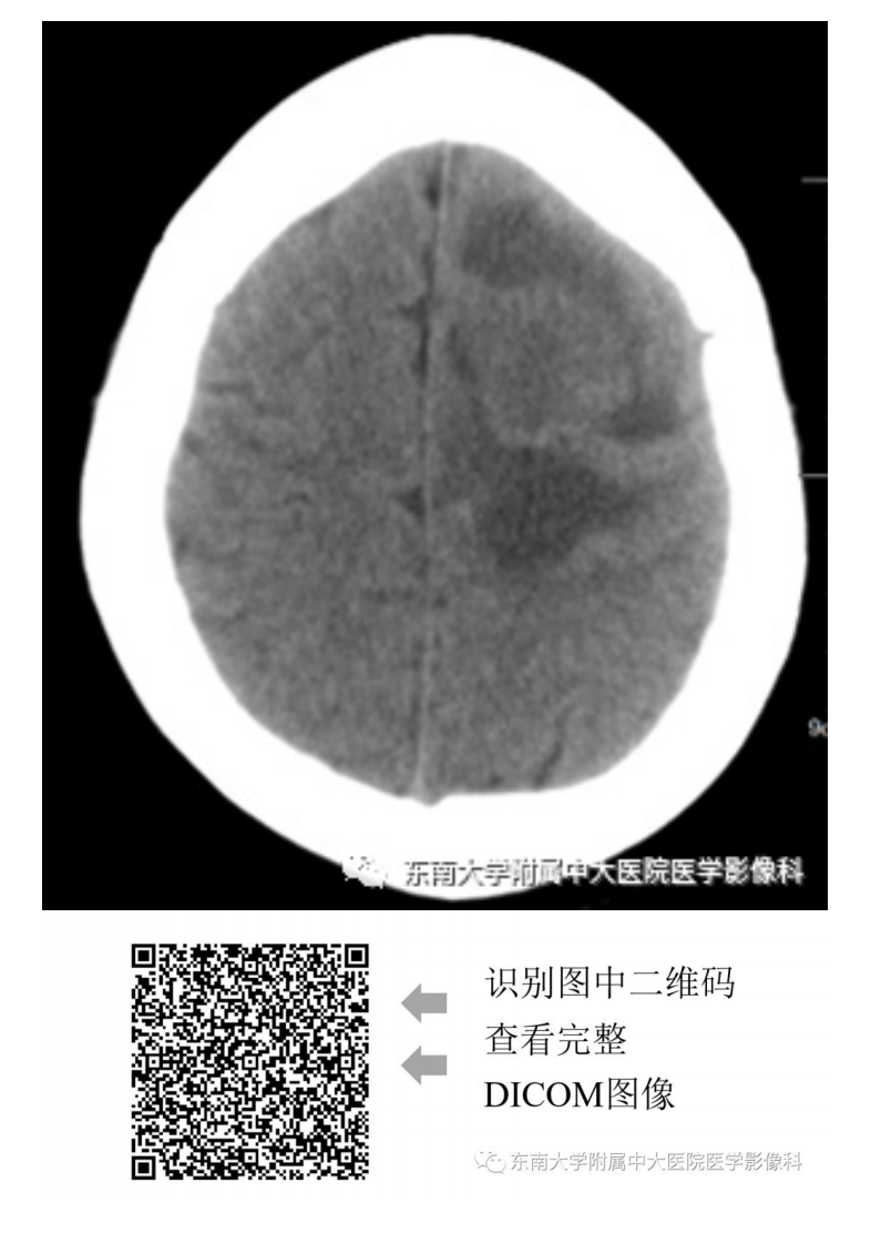 20190909_2【晨读结果公布】2019.09.09神经系统疾病.pdf 第4页