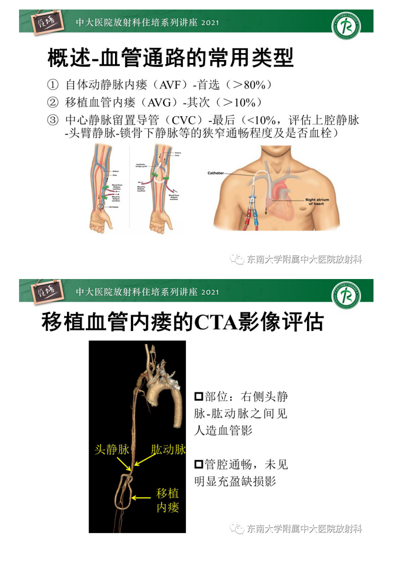 20210124_1【中大放射住培系列讲座】上肢动静脉解剖及人工动静脉造瘘术后CTA影像评估.pdf 第5页