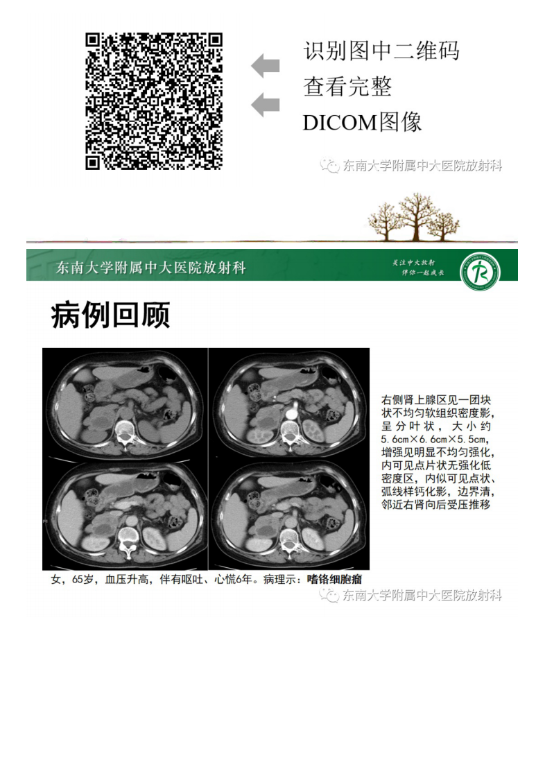 20210413_2【晨读结果公布】2021.04.13泌尿生殖系统疾病——肾上腺嗜铬细胞瘤.pdf 第2页