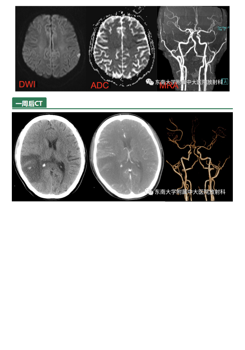 20210611_2【晨读结果公布】2021.06.10多系统疾病——SLE相关疾病.pdf 第2页