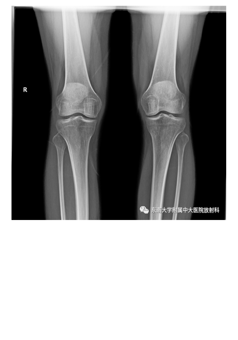20210506_3【晨读结果公布】2021.05.06肌骨系统疾病&mdash;&mdash;髌骨软化症.pdf 第2页