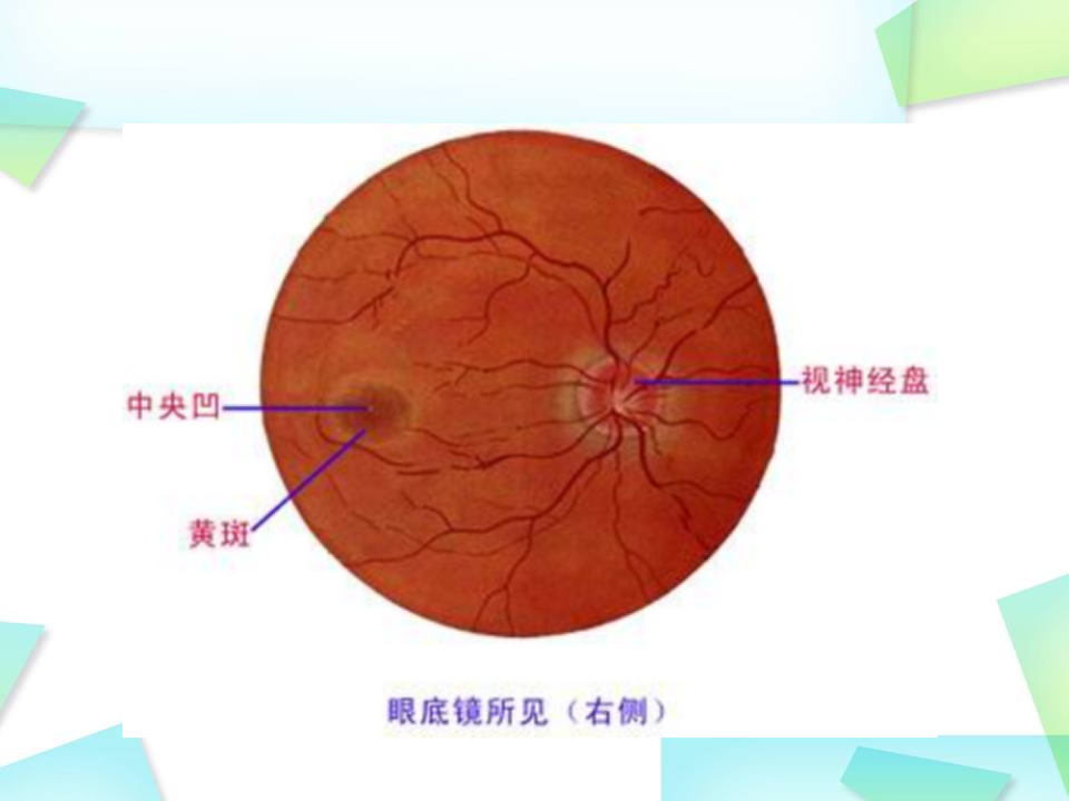12)视网膜病--2015春（五年制临床）吕雪漫.ppt 第4页