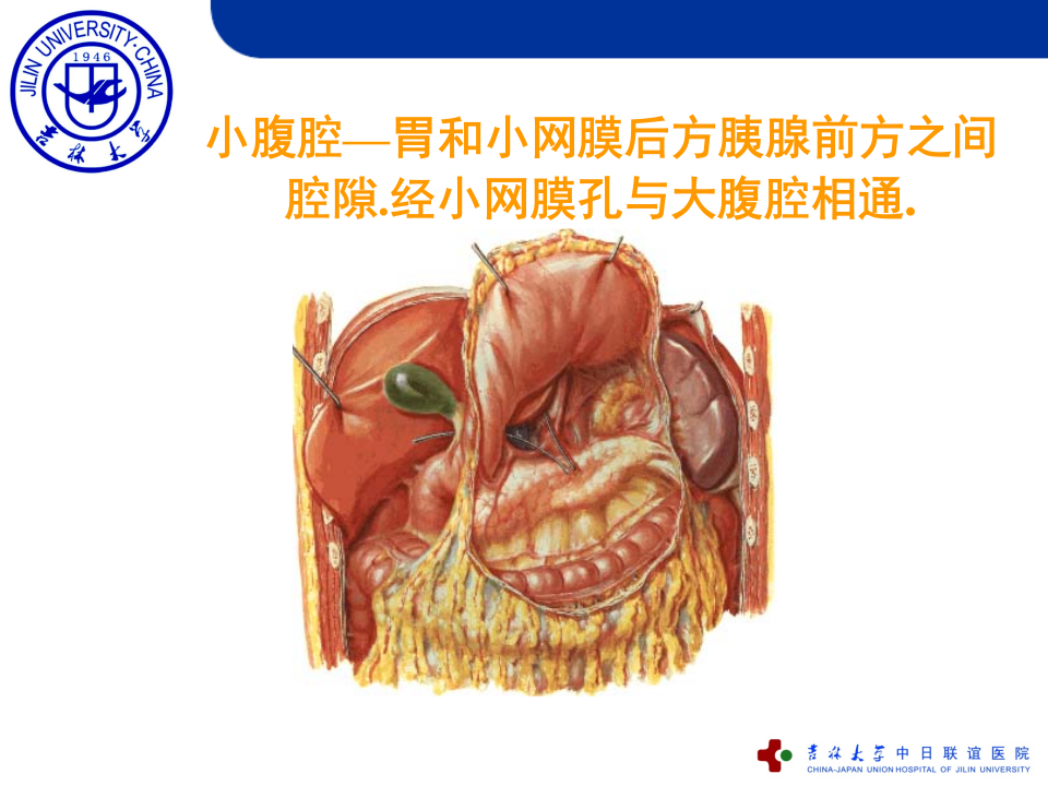 5)急性化脓性腹膜炎.ppt 第4页