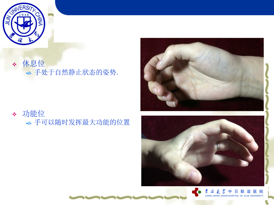 18)手外伤.ppt 第4页