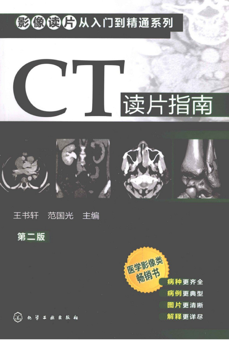 CT读片指南-王书轩.pdf 第1页