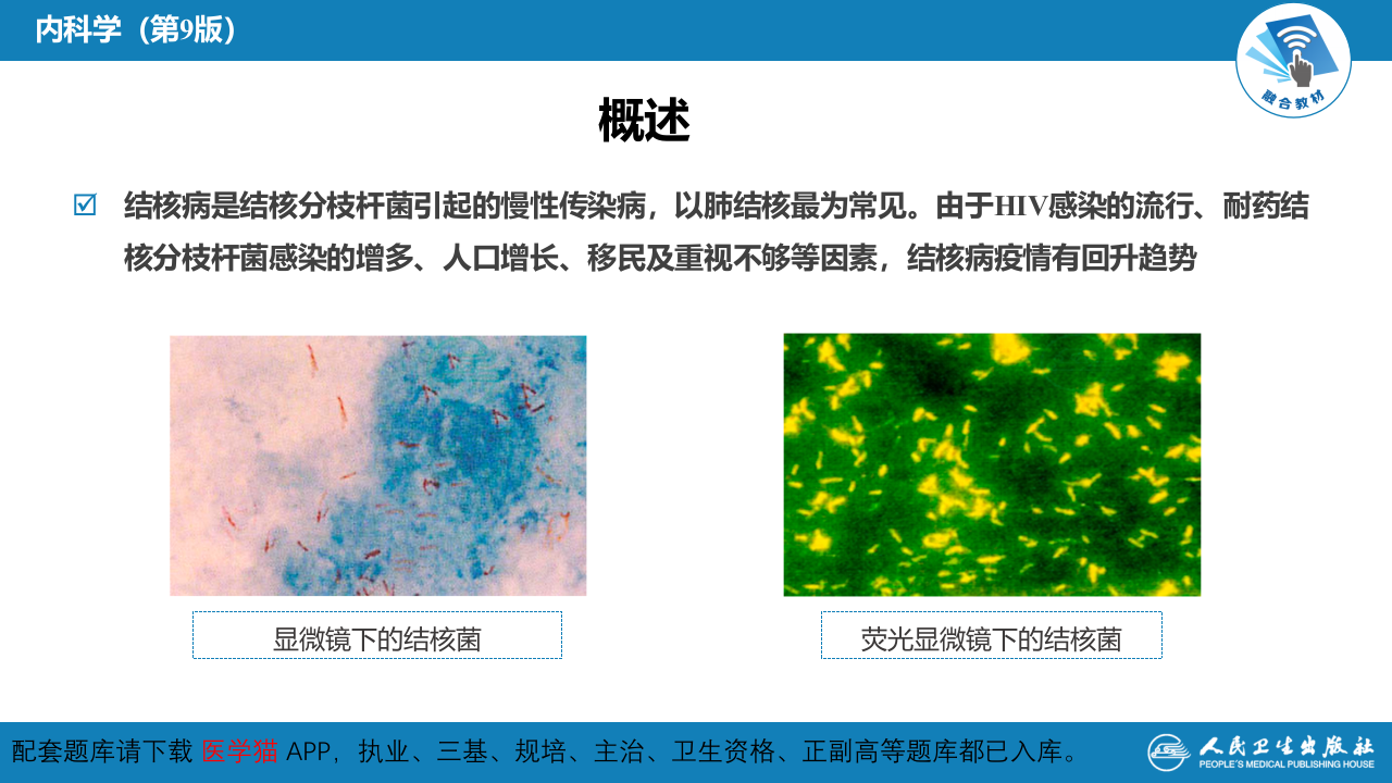 第七章  肺结核.pptx 第4页