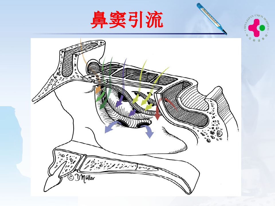 2)鼻窦炎.ppt 第5页