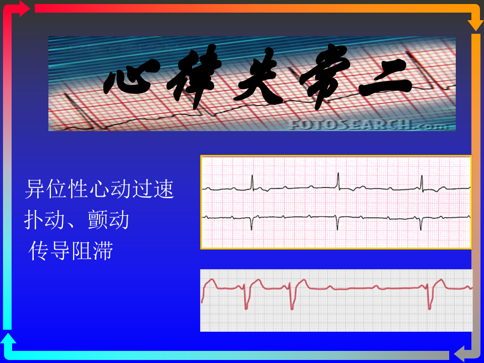 心电图－第五次课（心律失常二）.ppt 第1页