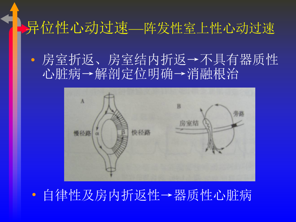 心电图－第五次课（心律失常二）.ppt 第2页
