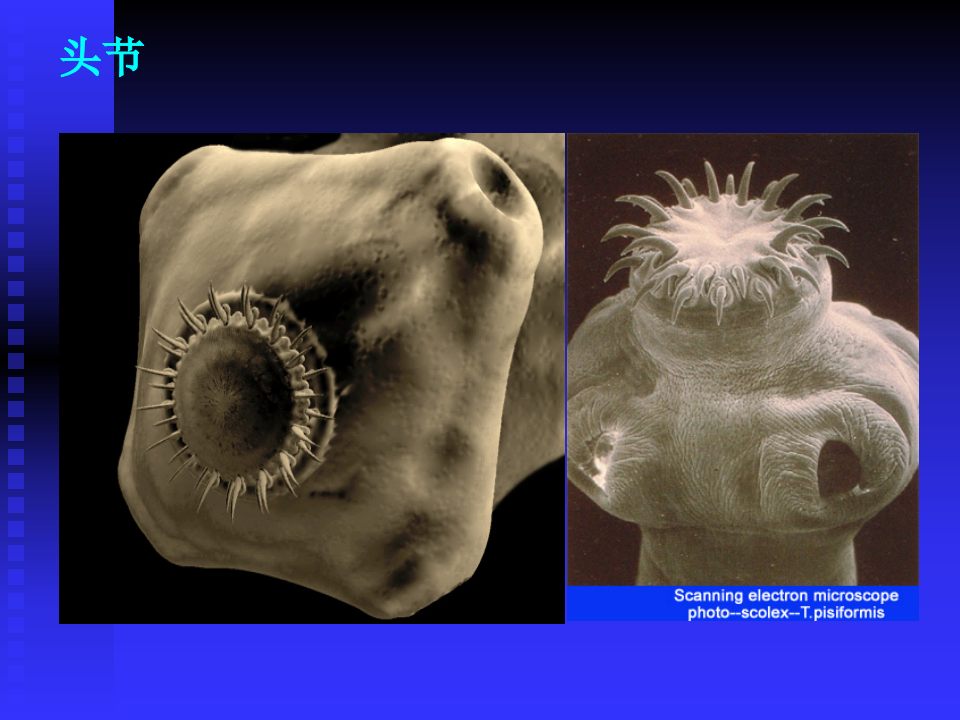 15)囊尾蚴病.ppt 第5页