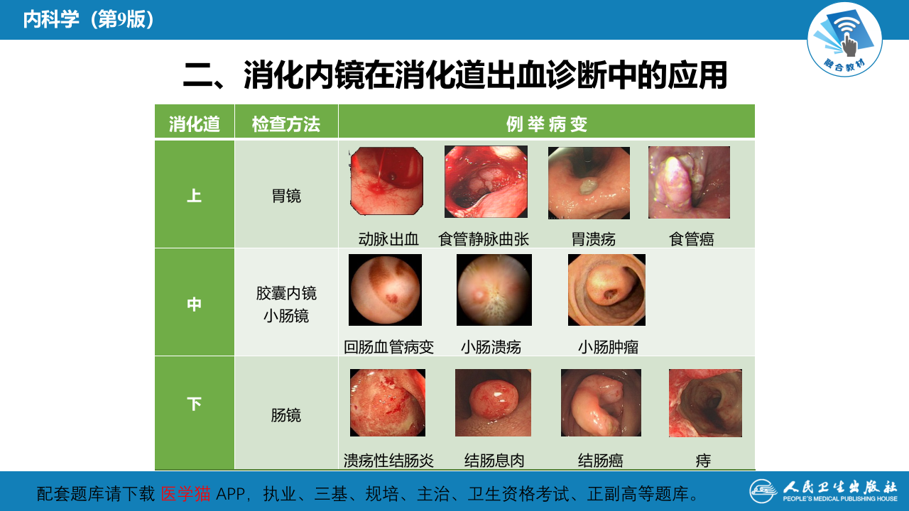 第二十五章  消化道出血.pptx 第5页