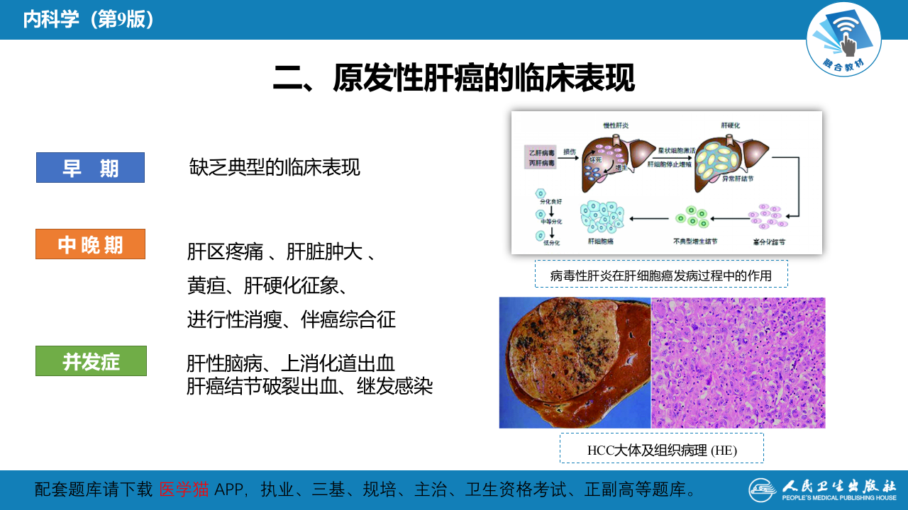 第十六章  原发性肝癌.pptx 第5页