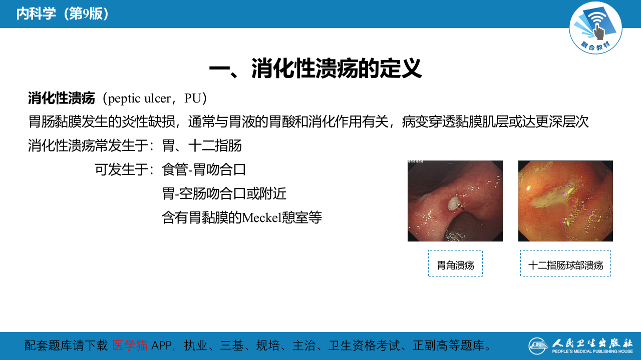 第五章  消化性溃疡.pptx 第4页