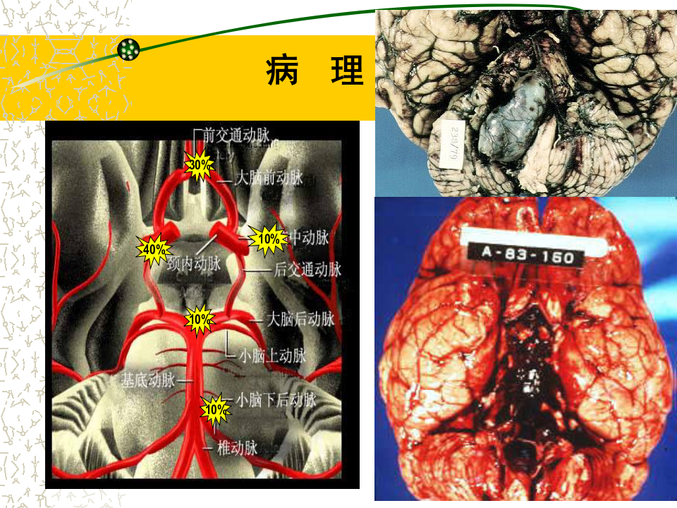 5)级放射口腔SAH.ppt 第5页