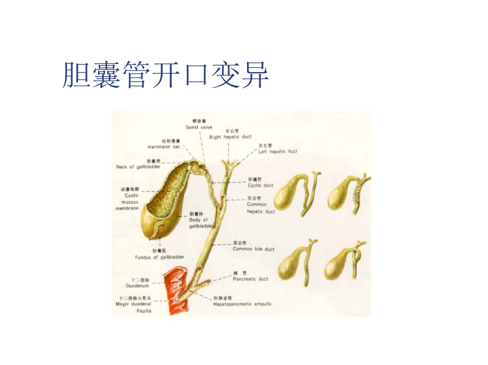 外科-胆囊结石及其防治.ppt 第3页
