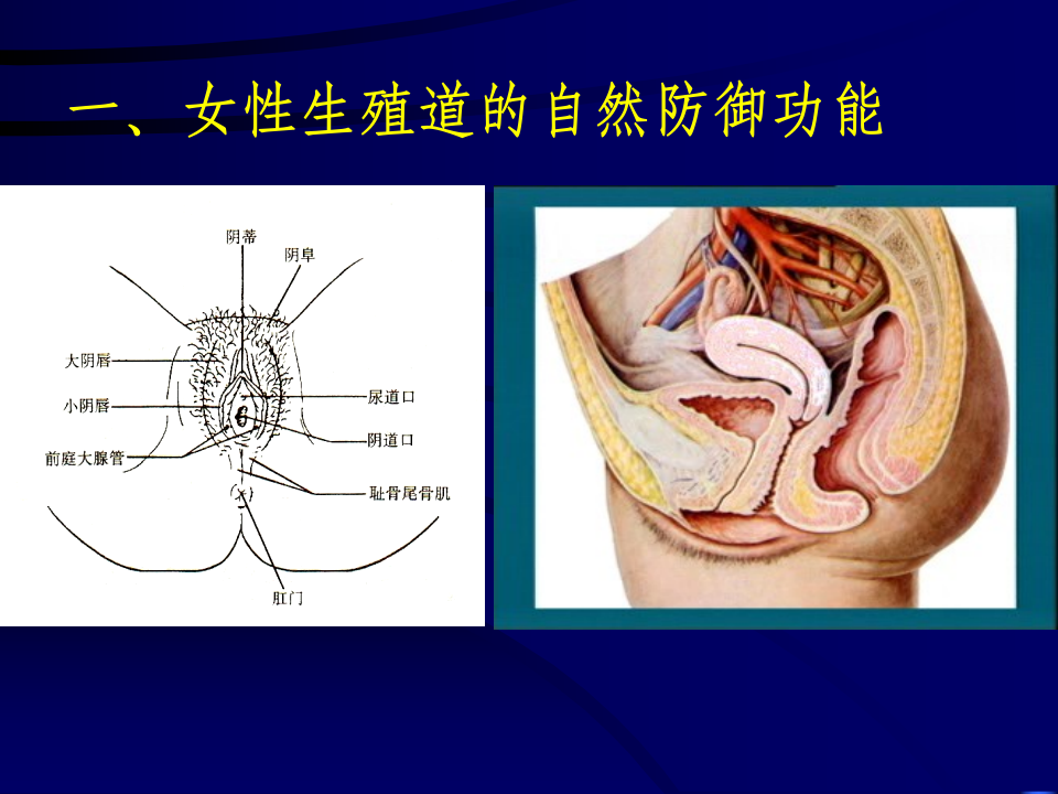 妇产科-盆腔炎.ppt 第4页