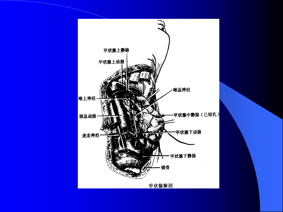 内分泌科-甲状腺和乳腺疾病的外科治疗.ppt 第4页