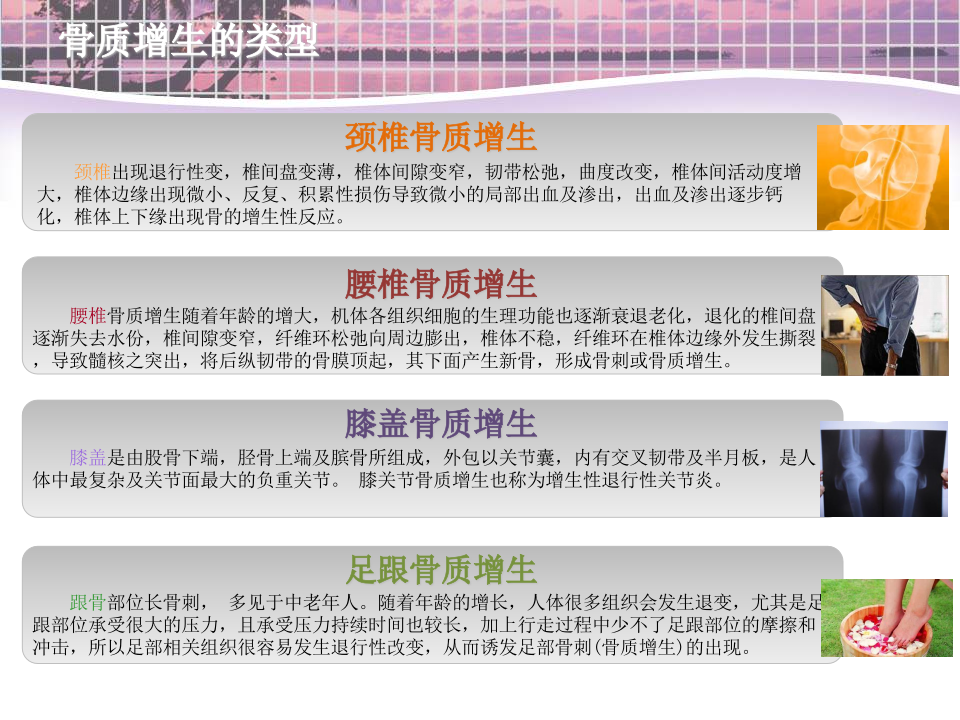 骨科-骨质增生的家庭治疗.ppt 第3页