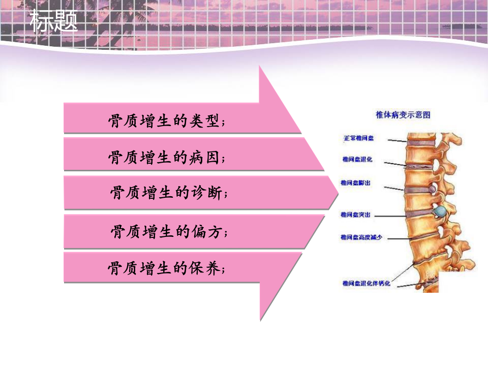 骨科-骨质增生的家庭治疗.ppt 第2页